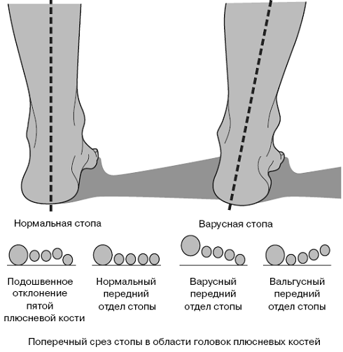 Все о здоровье ваших ног. От младенчества до старости