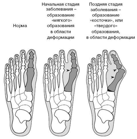 Все о здоровье ваших ног. От младенчества до старости
