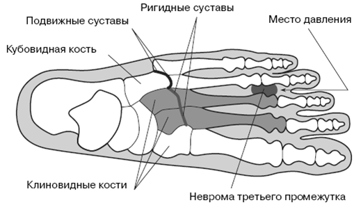 Все о здоровье ваших ног. От младенчества до старости